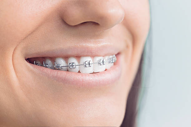 Best Traditional Braces  in Randallstown, MD